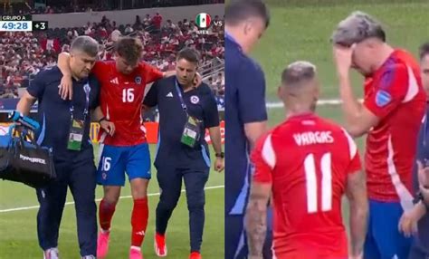Lesiones durante Chile Perú Copa América