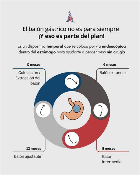 Balón gástrico ingerible dentro del estómago
