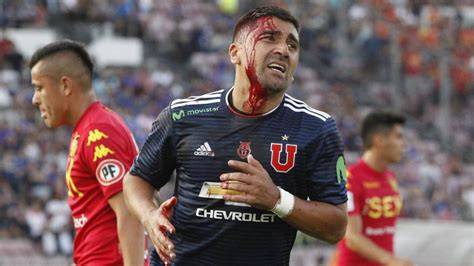 David Pizarro ensangrentado ante Unión Española