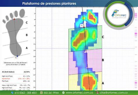 Mapa de hiperpresiones plantares rugby