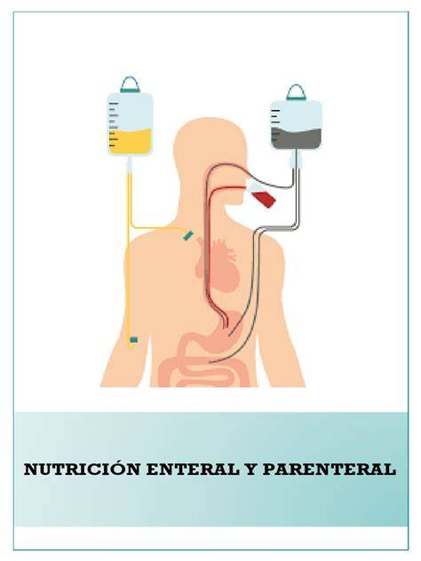 Esquema de nutrición enteral y parenteral