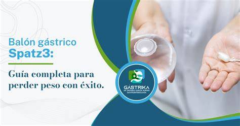 Colocación endoscópica del balón Spatz3