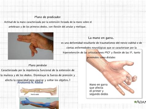 Límite de la mano según la axila