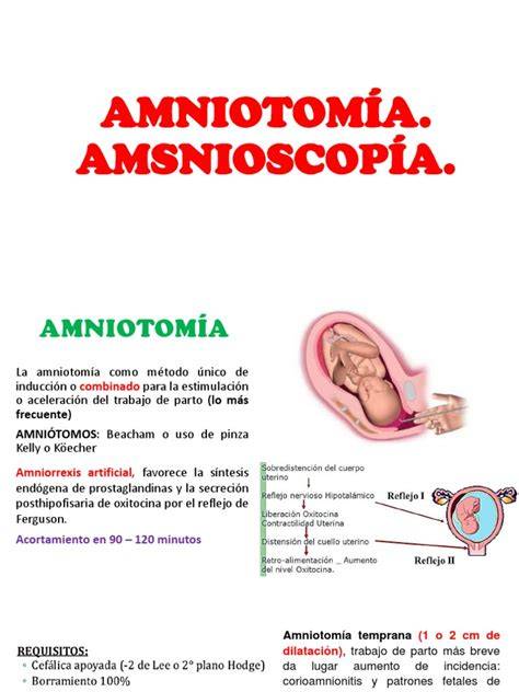 Comparación entre despegamiento y amniotomía