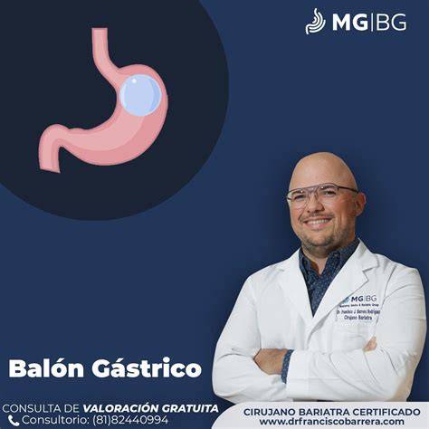 Evaluación multidisciplinaria para balón gástrico