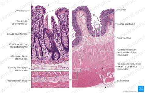 Histología de la mucosa del colon