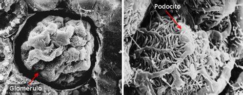 Podocitos y pedicelos glomerulares