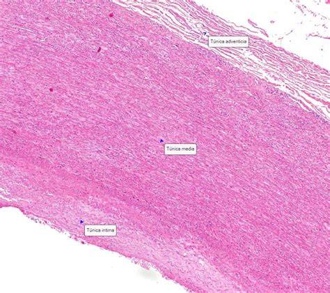 Arteria elástica teñida con hematoxilina eosina